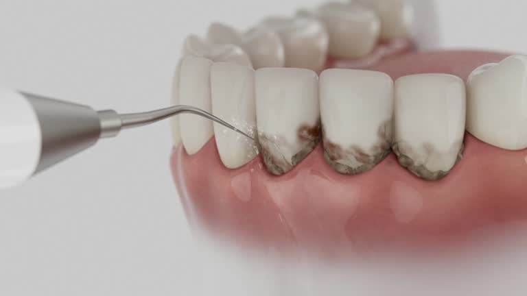 Trusted Tooth Extraction service in Emory, TX - Dentist Open Now